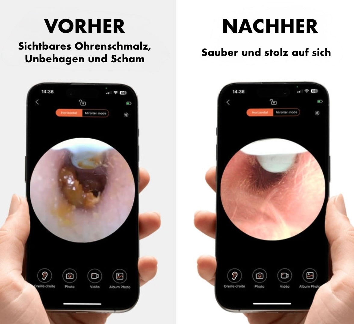 Smart Ohrreiniger mit Kamera-Olivara